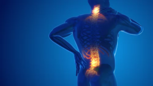 Minimally Invasive Spine Surgery